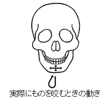 顎の動きを妨げる要因が発生した場合